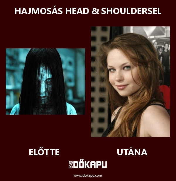 Hajmosás Head & Shouldersel
title=