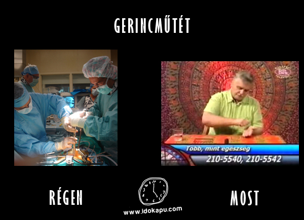 Gerincműtét
 
 title=